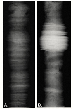 Digital X-ray imaging reveals clear layering (A) and a suspected earthquake-generated disturbance (B) in cores from Prince William Sound.